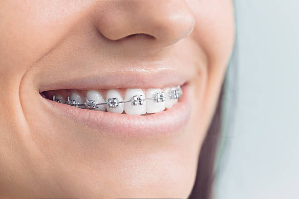 Best Tooth Extraction  in Washburn, IL